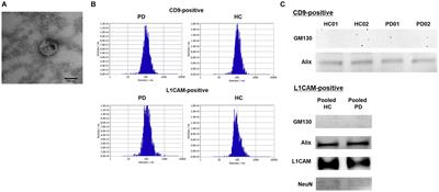 Assessment of acetylcholinesterase activity in CD9-positive exosomes from patients with Parkinson’s disease